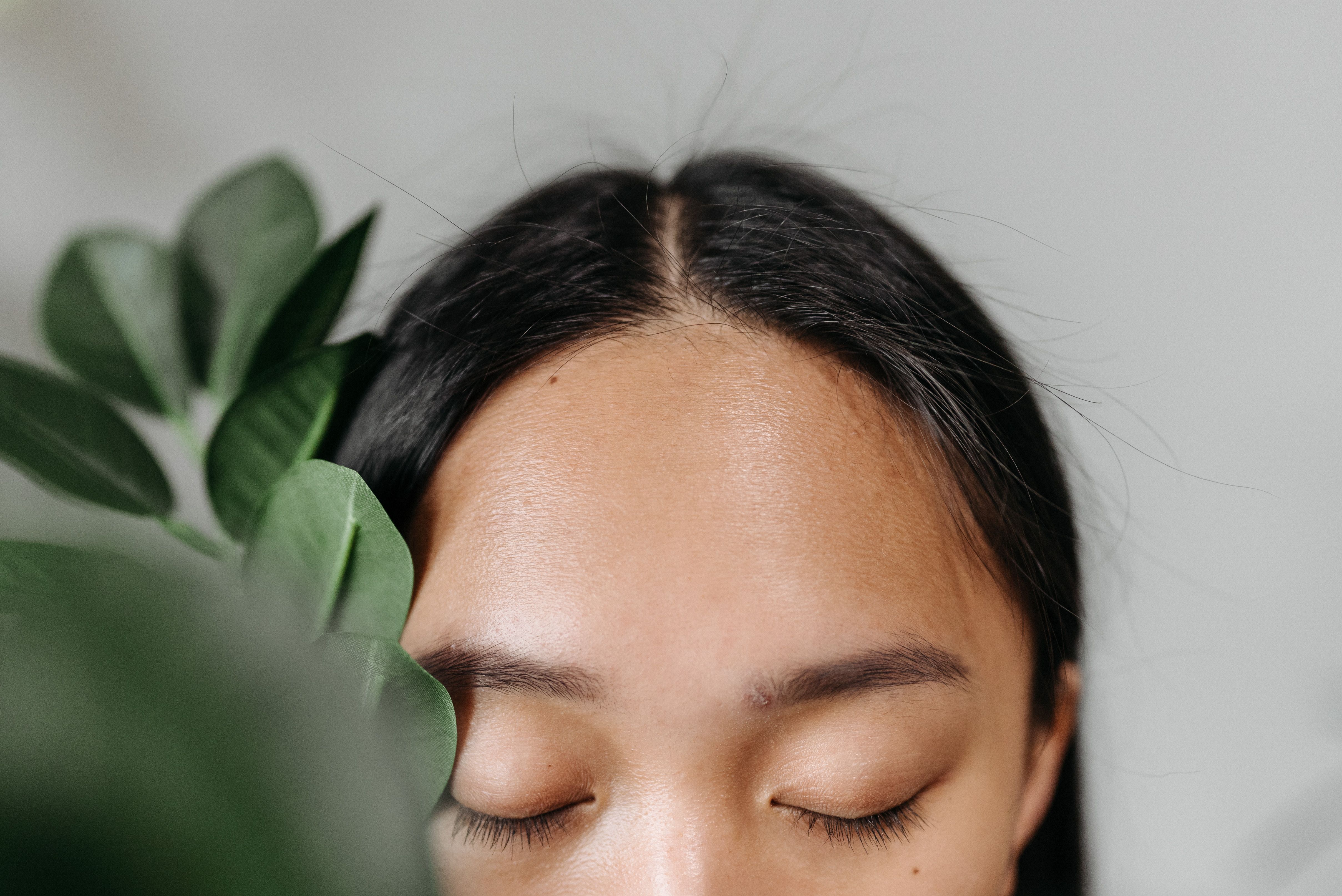 Forehead Lines