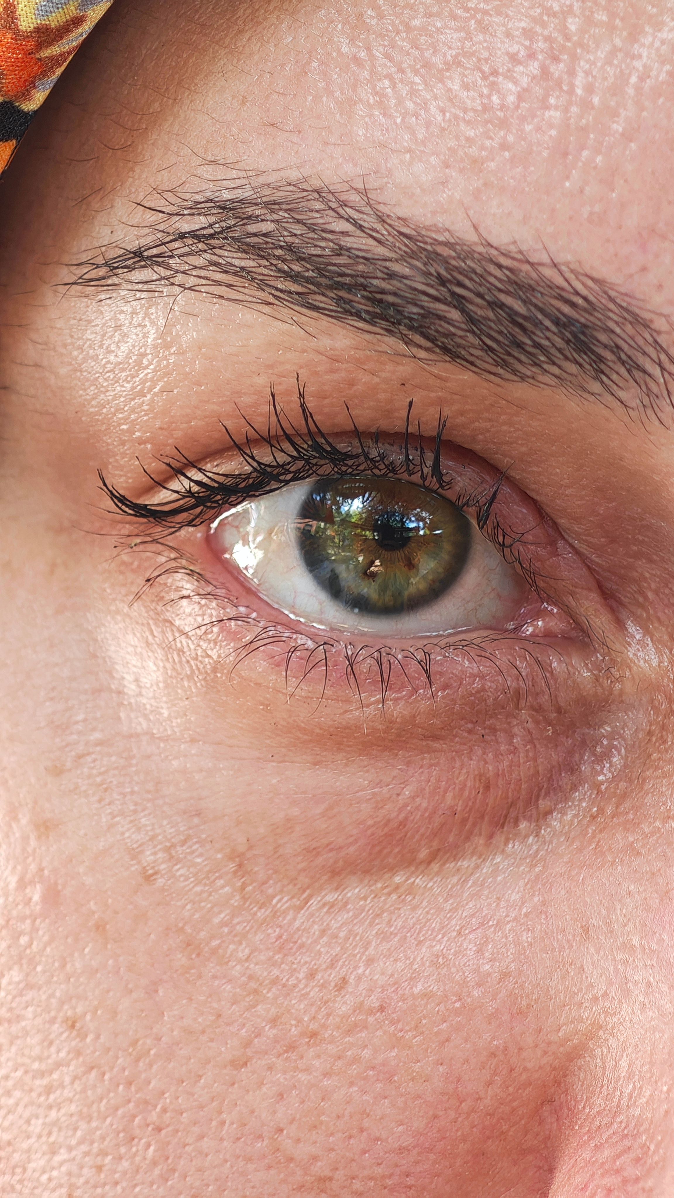 Under-Eye